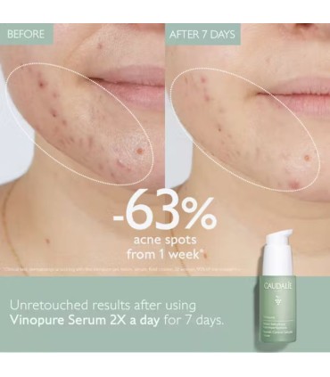 Caudalie Vinopure Sérum Salicílico Anti-imperfeições 30ml